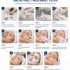 Curenex Snow Peel C-TOX powder and activator