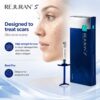 REJURAN S Scar syringe presentation for acne scar treatment