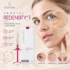 Teosyal Redensity 1 skin booster visual — hydrate, smooth and radiant look icons with crow's feet, forehead and glabellar line treatment areas