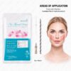 NEOGENESIS PDO Tornado Screw Multi Thread application areas oval face nasolabial fold